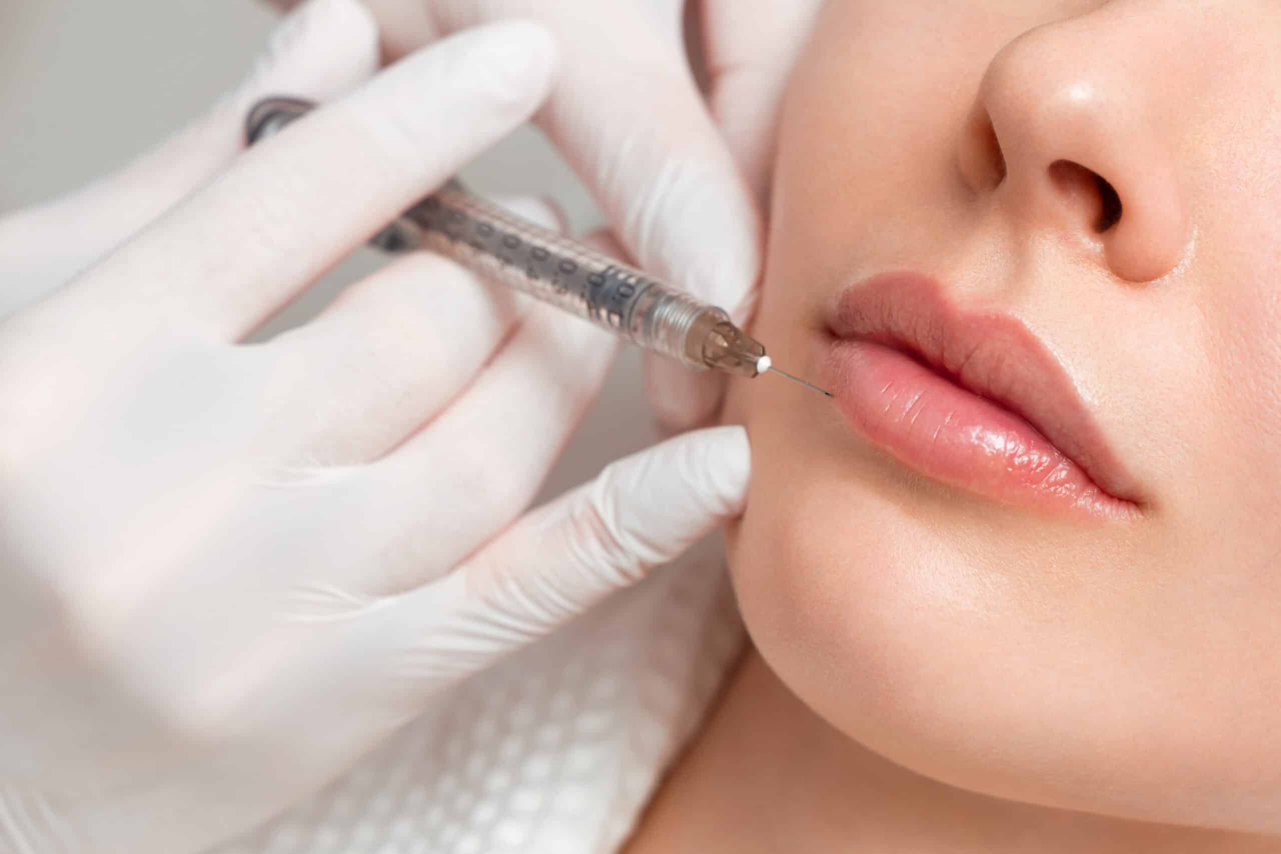 Sculptra in Baltimore, MD.