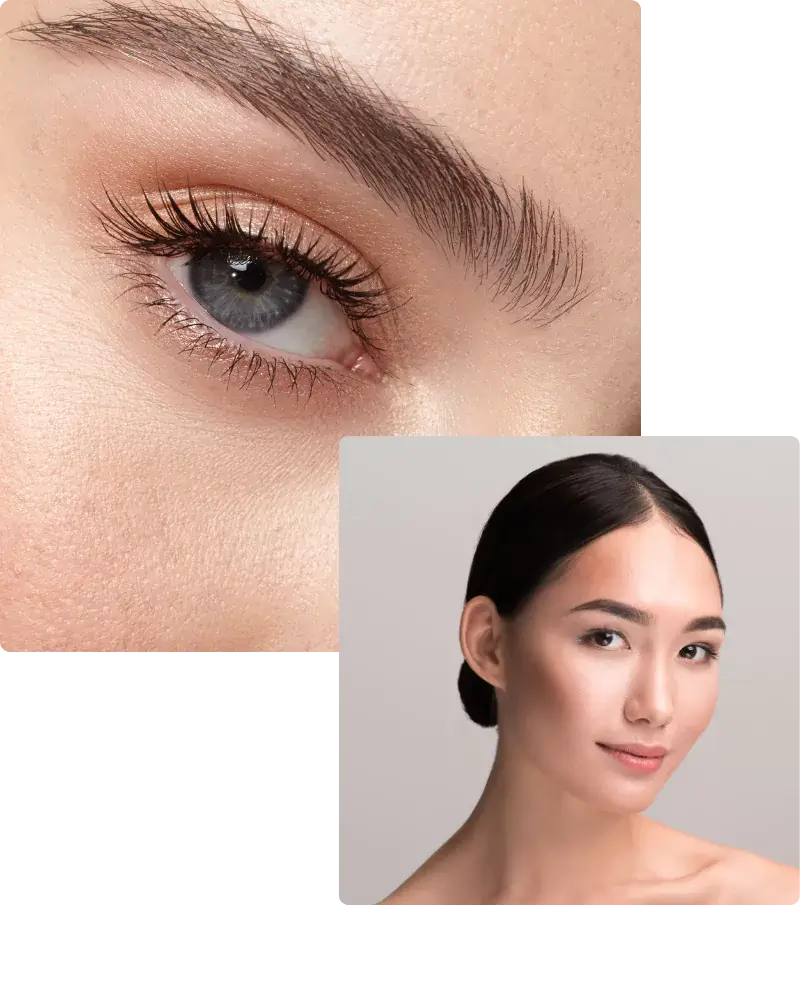 brow-lift-66c8d26c95683