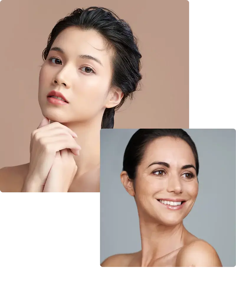 cheek-implants-66c8d268d6b33