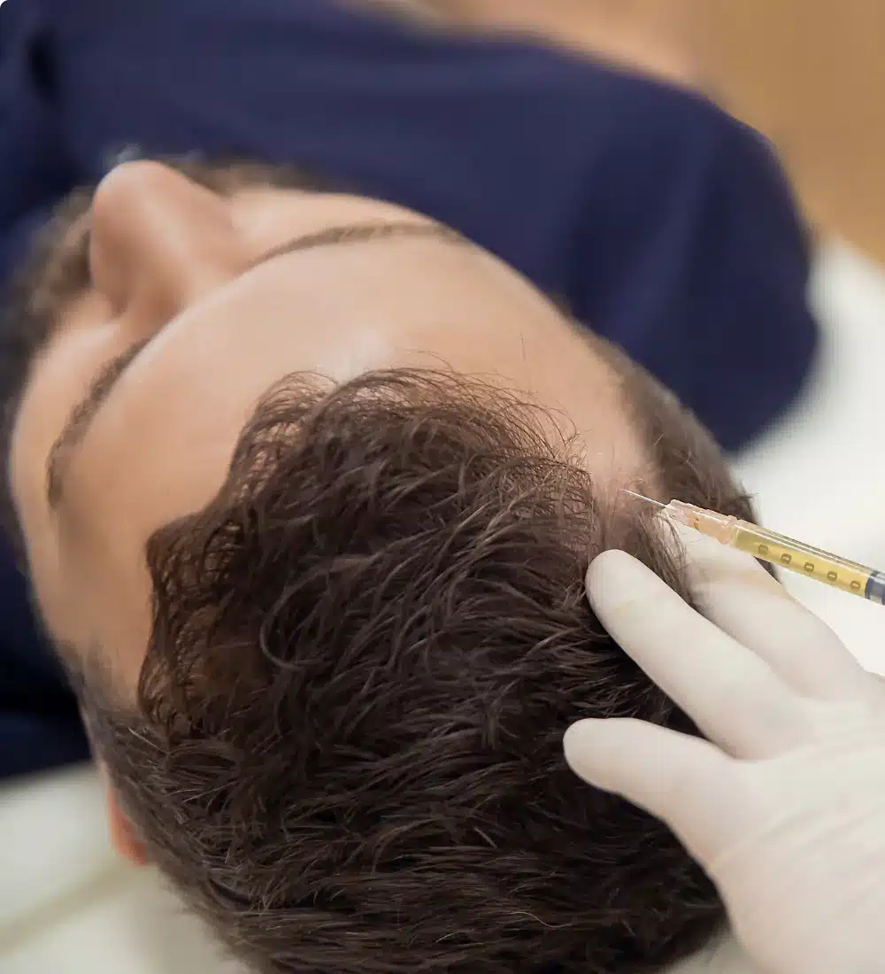 male-hair-restoration-injections male-hair-restoration-injections