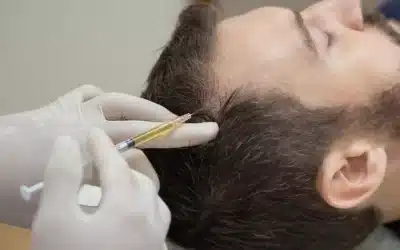 PRF for Hair Loss: Get Thicker, Healthier Hair Naturally